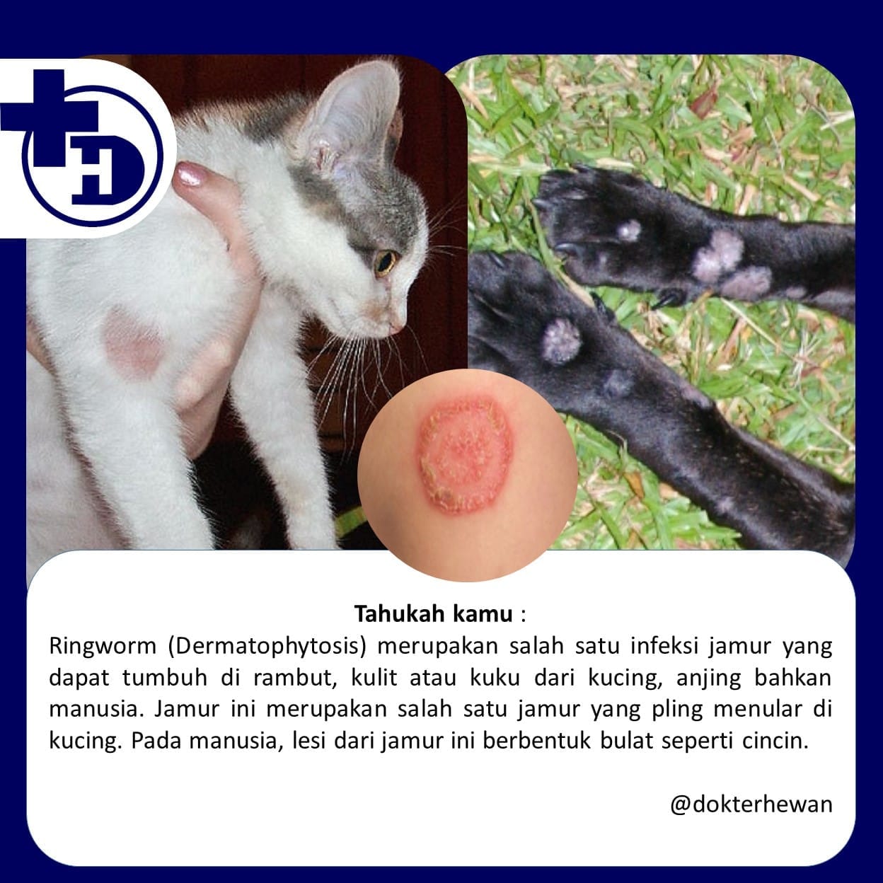 kuku, Ringworm, TikTok