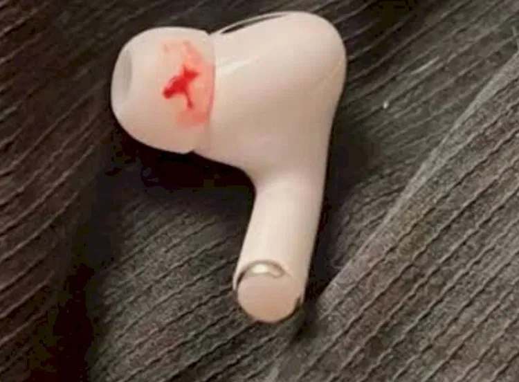 Airpods berdarah, bahaya suara keras earphone, gangguan pendengaran, tips menjaga telinga sehat, perawatan telinga, penggunaan earphone yang benar, tinitus, noise-cancelling earphones, gangguan pendengaran akibat earphone, infeksi telinga, risiko menggunakan earphone terlalu lama