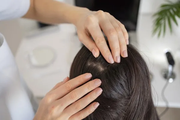 Bawang putih rambut sehat, salep rambut rontok, madu dan bawang putih, rambut kuat alami, perawatan rambut alami, cara atasi kerontokan, lidah buaya rambut, teh kamomil rambut, masker rambut bawang putih, tips rambut sehat, perawatan rambut alami.