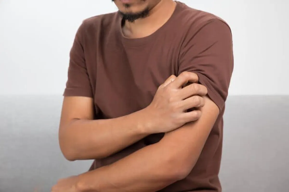 gatal di tubuh, penyebab gatal, kulit kering gatal, cacar bikin gatal, gigitan serangga, reaksi alergi, stres dan gatal, kesehatan kulit, alergi makanan, masalah kulit kronis, dermatitis dan psoriasis, penyebab cacar, ruam gatal tubuh, gejala skabies, gangguan mental gatal, gatal karena stres.